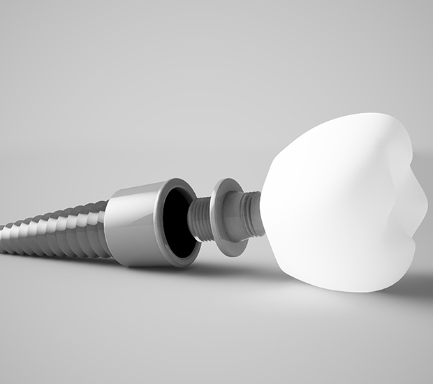 Grand Junction Prosthodontist